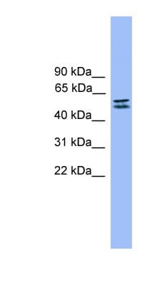 SPINT1 / HAI-1 Antibody (aa421-470)