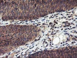 FGFR2 / FGF Receptor 2 Antibody (clone OTI5C5)