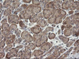 CATIP / C2orf62 Antibody (clone OTI2E6, Carrier-free)