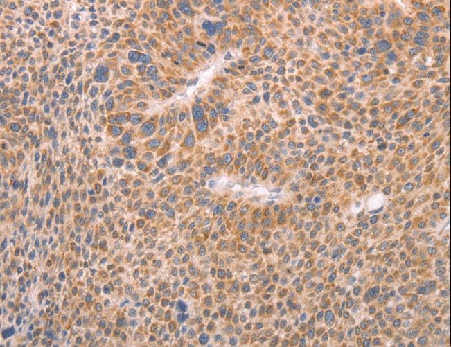 Polyclonal Rabbit anti-Human AASDHPPT / LYS5 Antibody (IHC, WB)