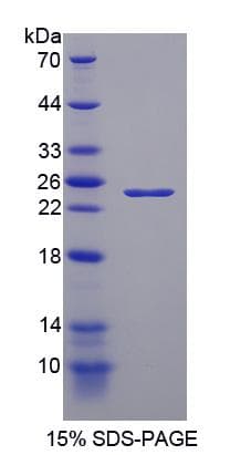 Mouse NEI3 / NEIL3 Protein (Recombinant His-S)