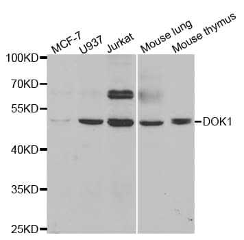 Polyclonal Rabbit anti-Human DOK1 Antibody (IHC, WB)