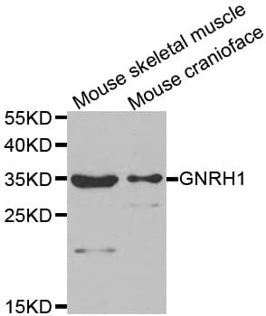 GNRH Antibody