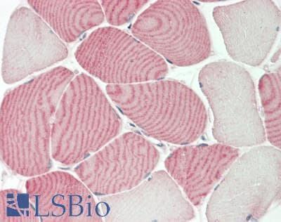 IHC-plus™ SLC36A2 Antibody