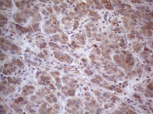 Monoclonal Mouse anti-Human RORB / ROR Beta Antibody (clone OTI1G1, aa1-260, IHC, WB)