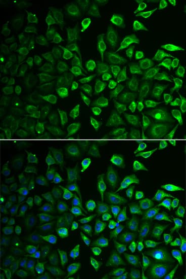 Polyclonal Rabbit anti-Human IMPA1 / IMP Antibody (IHC, IF, WB)