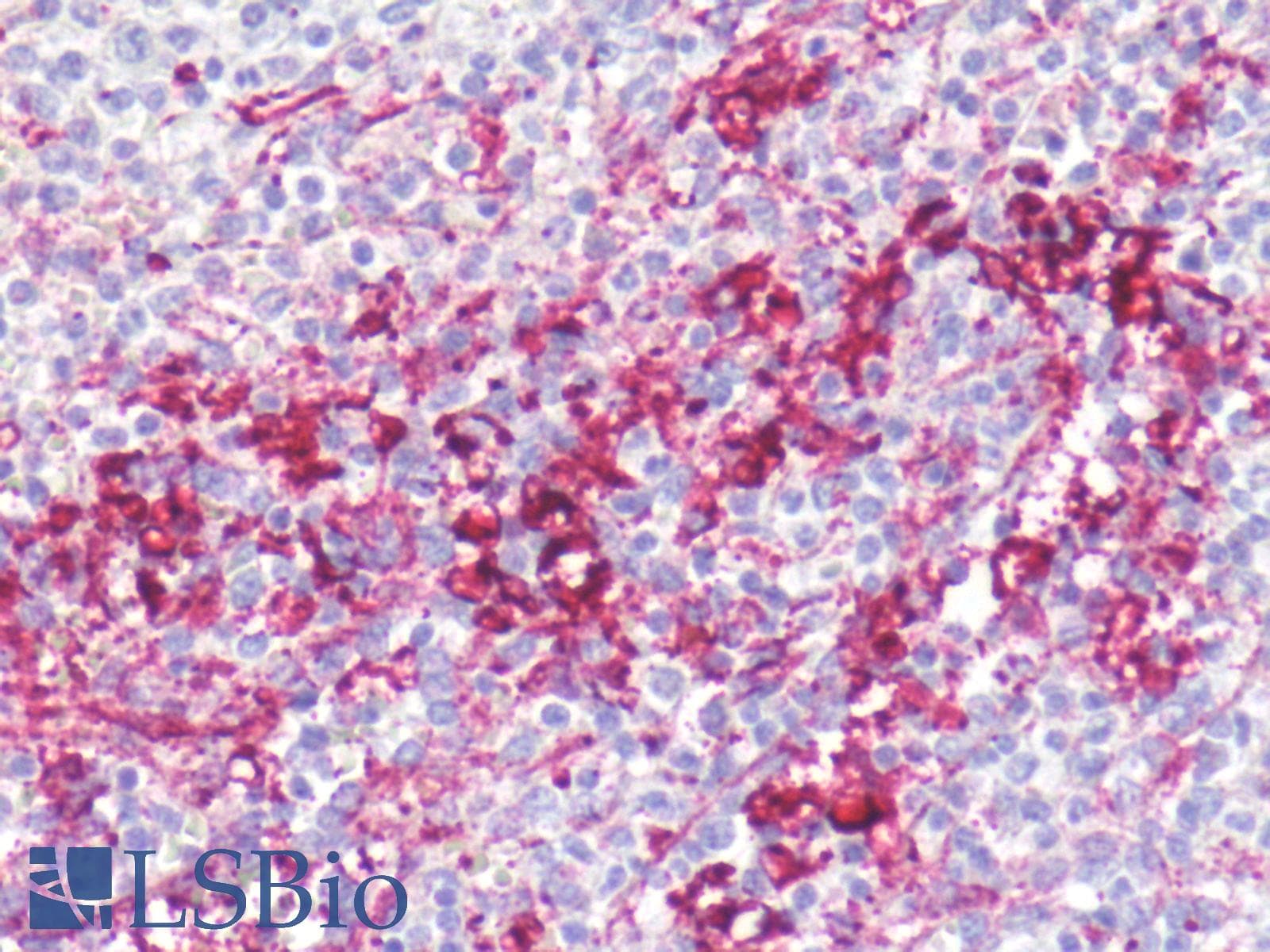 IHC-plus™ Polyclonal Rabbit anti-Human CXCR1 Antibody (Internal, IHC)