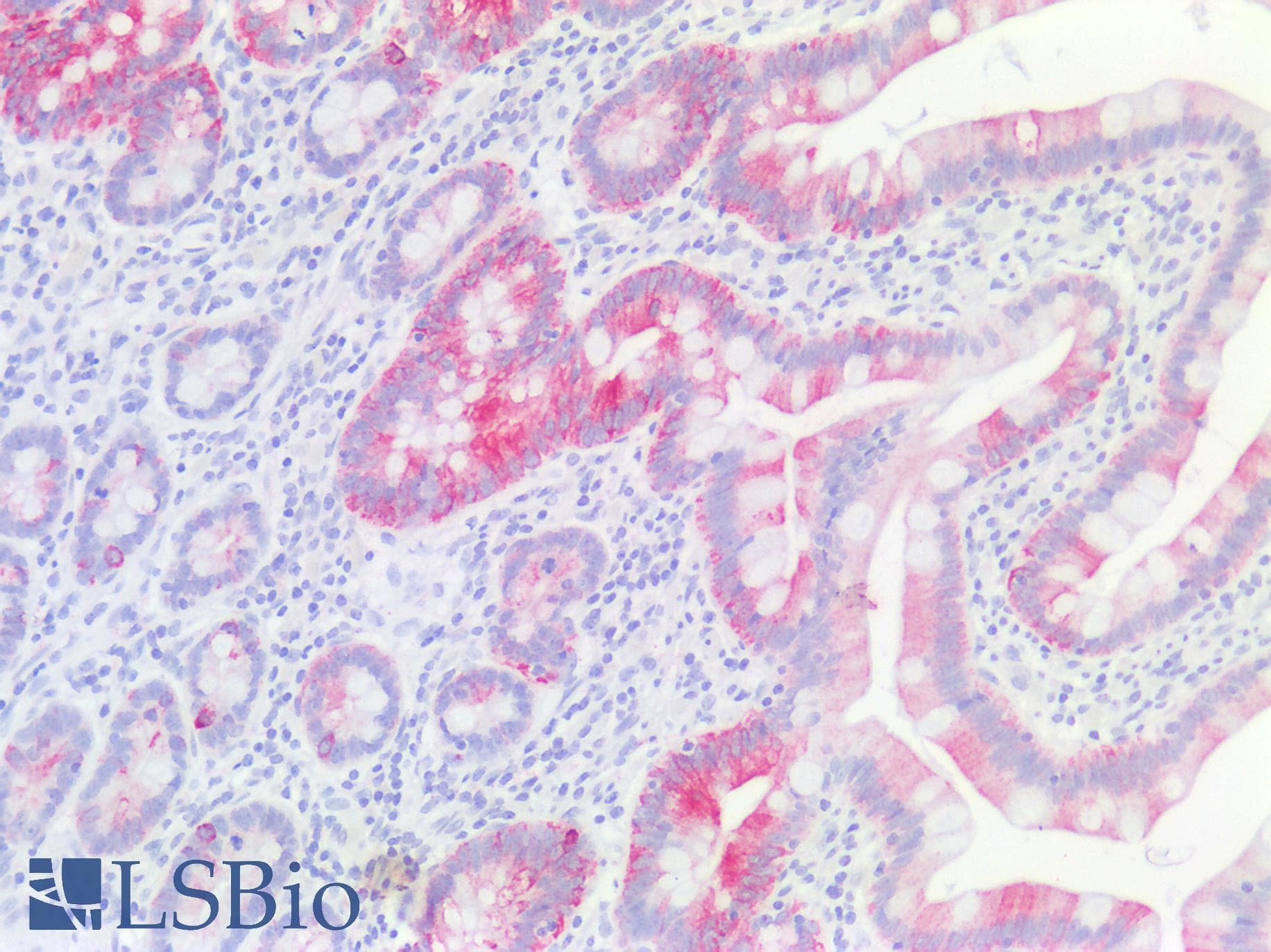 PathPlus™ KRT18 / CK18 / Cytokeratin 18 Antibody (aa48-97)