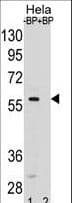 SMAD5 Antibody (aa241-269)
