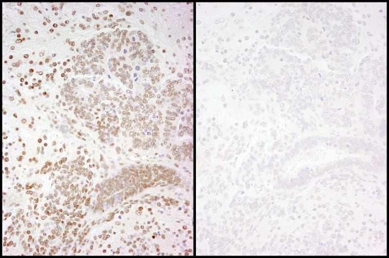 Polyclonal Rabbit anti-Human POLR2A / RNA polymerase II Antibody (phospho-Ser2, IHC)