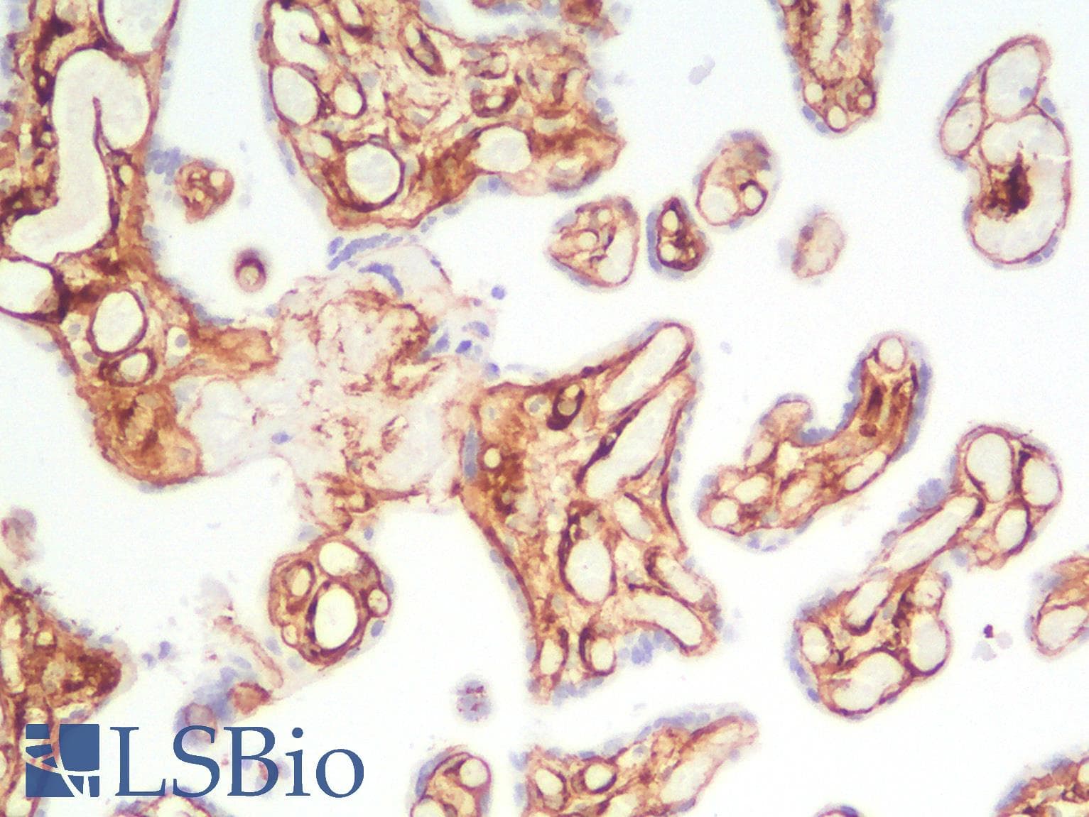 PathPlus™ Collagen IV Antibody (Concentrated)