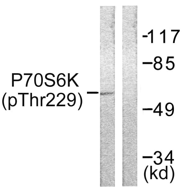 Polyclonal Rabbit anti-Human RPS6KB1 / P70S6K / S6K Antibody (phospho-Thr229, IHC, WB)