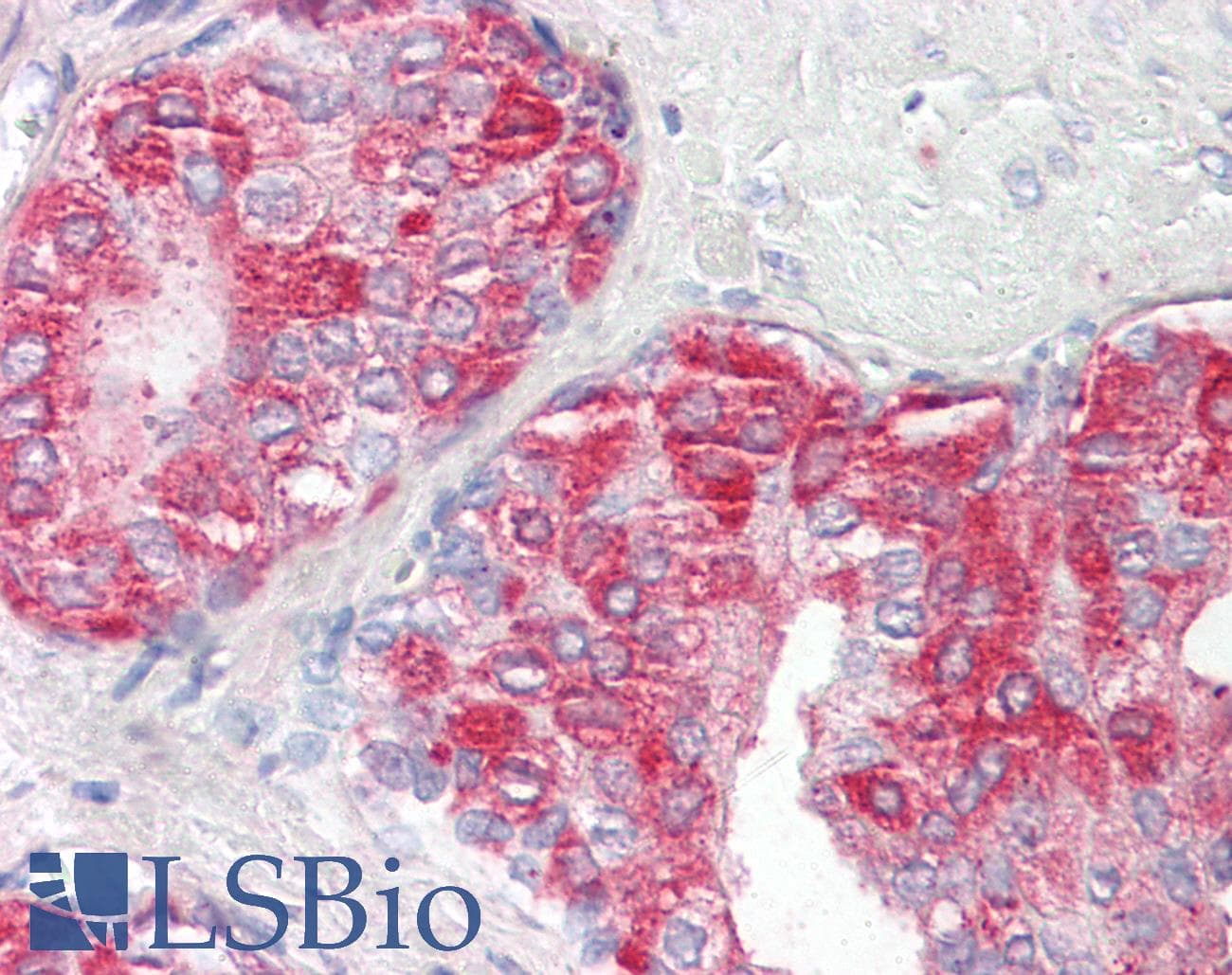 PathPlus™ ACPP / PAP Antibody (aa200-300)