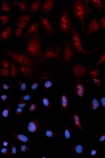 PLCB1 / Phospholipase C Beta 1 Antibody