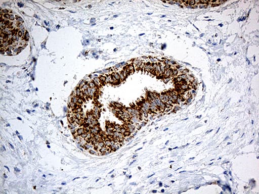 Monoclonal Mouse anti-Human CHCHD10 Antibody (clone OTI2B6, aa17-142, IHC, WB)