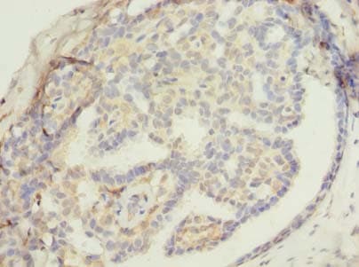 ZNF626 Antibody