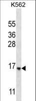 STARD5 Antibody (aa26-55)