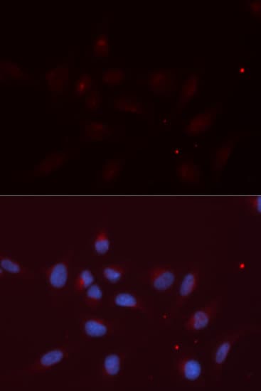 Polyclonal Rabbit anti-Human APLP2 Antibody (IHC, IF, WB)
