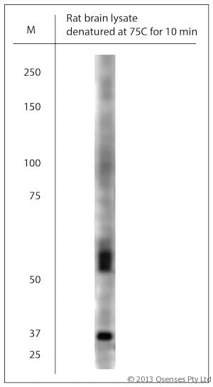 SLC17A7 / VGLUT1 Antibody (aa500-560)