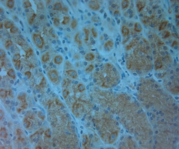 ABCC6 / MRP6 Antibody (aa825-875)