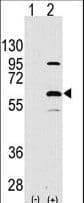 Polyclonal Rabbit anti-Human ELP3 Antibody (aa9-44, WB)
