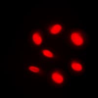 ARID1B / BAF250B Antibody (Internal)