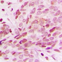 RBM5 / G15 Antibody (Internal)