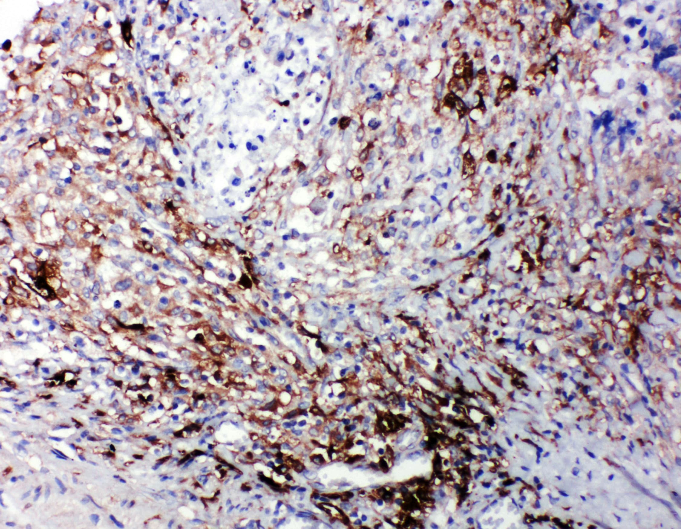 Polyclonal Rabbit anti-Human LTBR Antibody (aa420-435, IHC, WB)