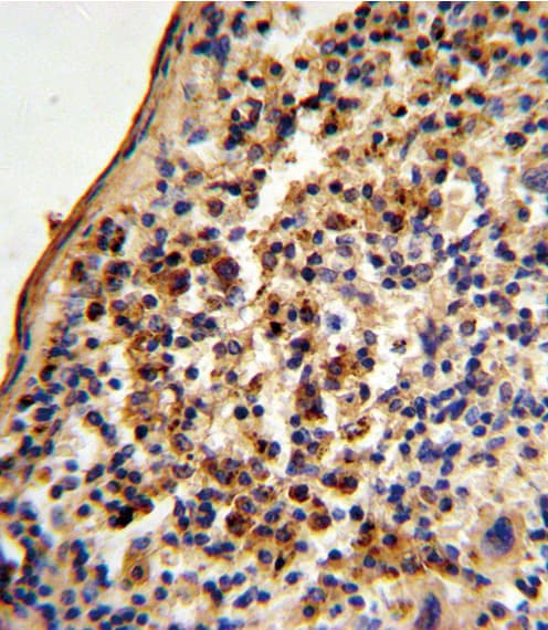 XRCC6 / Ku70 Antibody (aa432-461)