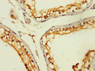 ZNF562 Antibody