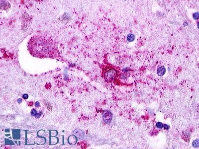 PathPlus™ Polyclonal Rabbit anti-Human GPR49 / LGR5 Antibody (Cytoplasmic Domain, IHC, IF)