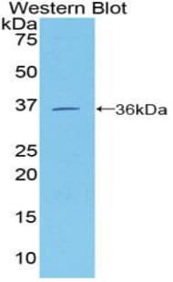 MCAM / CD146 Antibody (aa224-464)