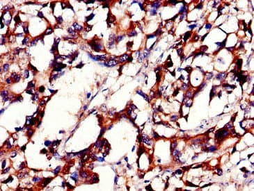 PHLDB2 Antibody