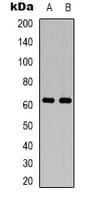 PAK2 Antibody (Internal)