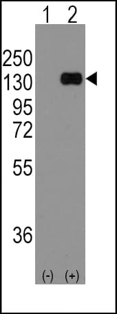 CDH1 / E Cadherin Antibody (aa833-862)
