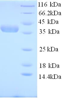 Human NAPRT Protein (Recombinant His)