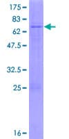 Human CHST14 Protein (Recombinant GST)