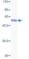 Human SCEH / ECHS1 Protein (Recombinant GST)