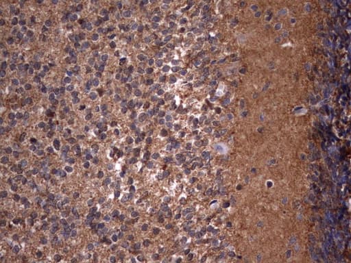 HMBS / PBGD Antibody (clone UMAB144)