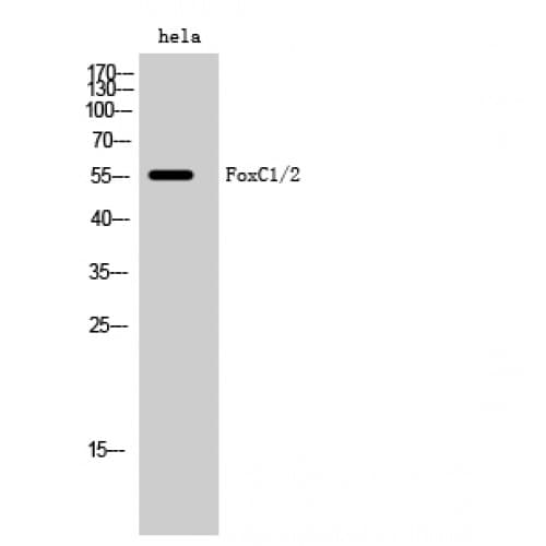 FOXC1+2 Antibody (120-200 aa, Internal)