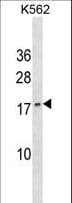 Polyclonal Rabbit anti-Human GCHFR Antibody (aa38-66, WB)