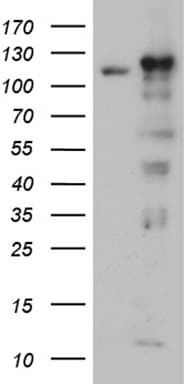 IPO5 / RANBP5 Antibody (aa1-220, clone OTI4C3)