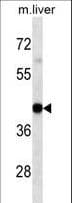 IHC-plus™ Monoclonal Mouse anti-Human HLA-A Antibody (aa70-99, IHC, WB)