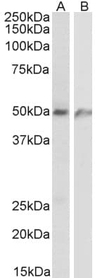 IHC-plus™ ECSCR Antibody (aa193-205)