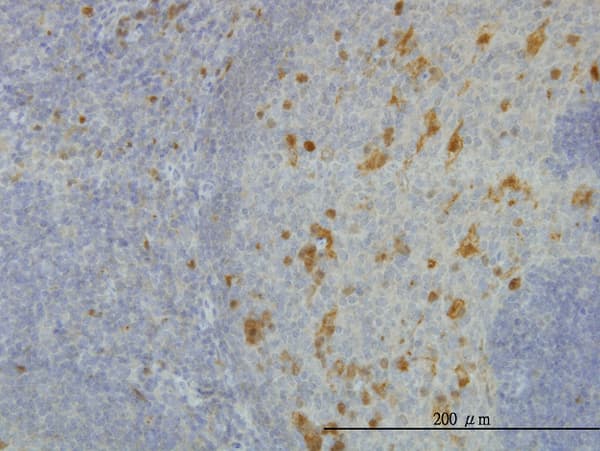 AKR1A1 Antibody (clone 1A11-2A4)