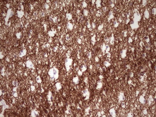 NCAM / CD56 Antibody (aa20-718, clone UMAB192, Carrier-free)