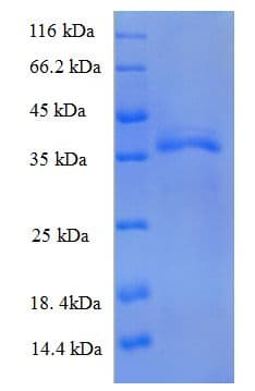 Human HLA-B Protein (Recombinant 6His, N-terminus)