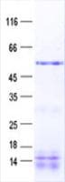 Human VPS37A Protein (Recombinant His, N-Terminal)
