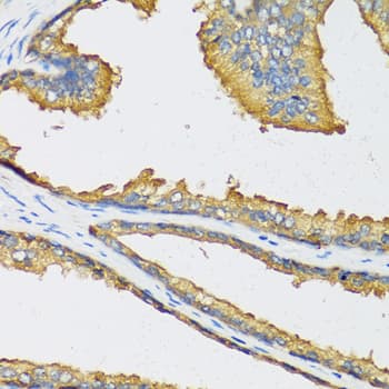 Polyclonal Rabbit anti-Human CXCL11 Antibody (IHC, WB)