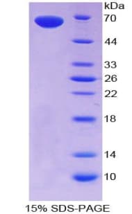 Human THPO / TPO / Thrombopoietin Protein (Recombinant His-GST)